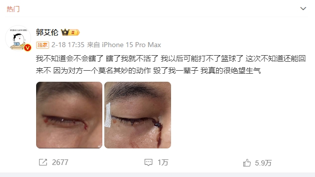 郭艾伦遭遇眼部重伤后再发声：“被网暴过所以不想让别人经历但事后遭遇让我寒心”(图1)